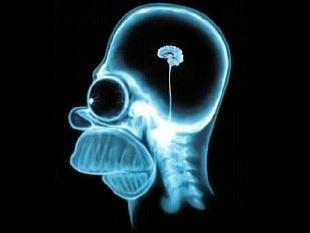 cervello minimo